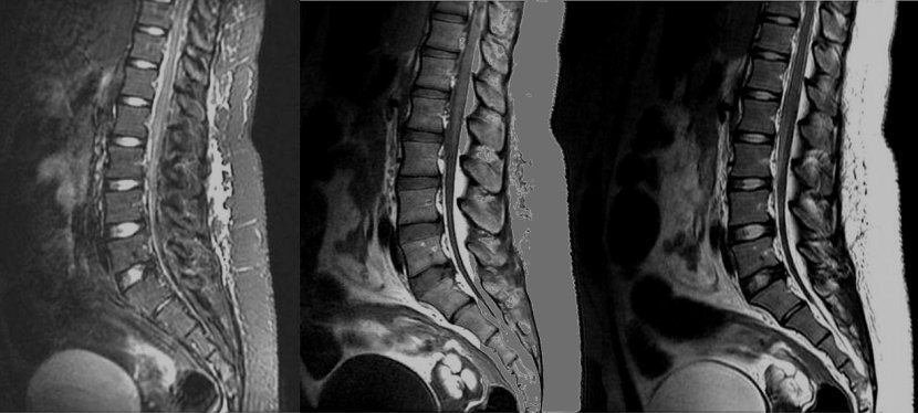 Advanced Imaging. Part&nbsp;2.